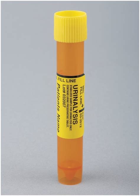 torn seal on urinalysis test vial|interpretation of urinalysis tests.